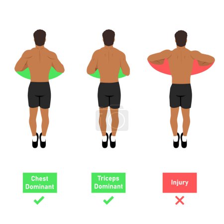 Illustration for The push up dominant muscle. How to do push up from top view. Hand position. Chest and tricep or injury dominant. Neutral position and internal rotation. Flat vector illustration isolated on white - Royalty Free Image