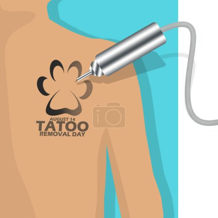 Illustration for Laser tattoo removal tool that is removing tattoos on the customer's body, with bold text on white background to commemorate National Tattoo Removal Day on August 14 - Royalty Free Image