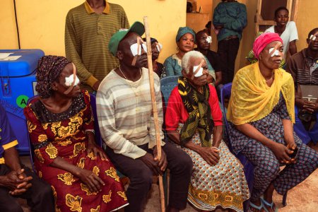 Téléchargez les photos : Abuja, Nigéria - 25 décembre 2021 : Des Africains d'âge moyen diagnostiqués de cataracte et préparés pour la chirurgie. - en image libre de droit