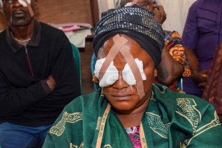 Photo for Abuja, Nigeria - December 25, 2021: Middle-aged African people Diagnosed of Cataract and Prepared for Surgery. - Royalty Free Image