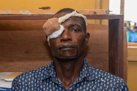 Foto de Abuja, Nigeria - 25 de diciembre de 2021: Hombre africano de mediana edad diagnosticado de catarata en el ojo y preparado para cirugía - Imagen libre de derechos