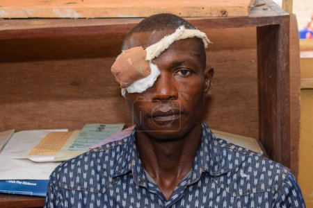 Téléchargez les photos : Abuja, Nigeria - 25 décembre 2021 : Homme africain d'âge moyen diagnostiqué de cataracte dans l'œil et préparé pour la chirurgie - en image libre de droit