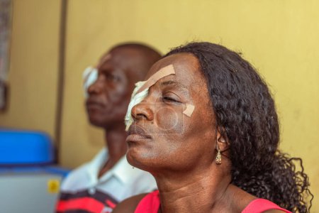 Téléchargez les photos : Abuja, Nigéria - 25 décembre 2021 : Des Africains d'âge moyen diagnostiqués de cataracte dans l'œil et préparés pour la chirurgie - en image libre de droit