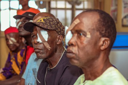 Photo for Abuja, Nigeria - December 25, 2021: Middle-aged African people Diagnosed of Cataract in the eye and Prepared for Surgery - Royalty Free Image