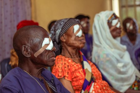 Téléchargez les photos : Abuja, Nigéria - 25 décembre 2021 : Des Africains d'âge moyen diagnostiqués de cataracte dans l'œil et préparés pour la chirurgie - en image libre de droit
