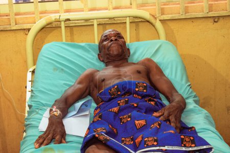 Téléchargez les photos : État d'Edo - 25 décembre 2021 : Un homme africain âgé se remet sur un lit de malade dans une clinique rurale après une chirurgie réussie - en image libre de droit