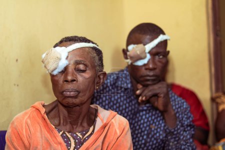 Foto de Abuja, Nigeria - 25 de diciembre de 2021: Personas de mediana edad africanas diagnosticadas de catarata en el ojo y preparadas para la cirugía - Imagen libre de derechos