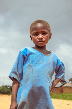 Foto de Plateau State, Nigeria - 5 de junio de 2022: Retrato de un niño africano. Momentos francos al azar con un niño africano al aire libre en un cielo azul soleado. - Imagen libre de derechos