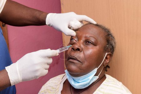 Photo for Abuja, Nigeria - August 9, 2021: Africans people diagnosed of cataract in the eye and prepared for surgery - Royalty Free Image