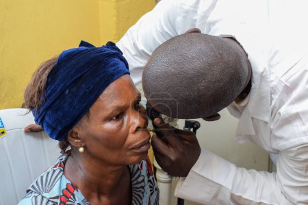 Photo for Abuja, Nigeria - August 9, 2021: Africans people diagnosed of cataract in the eye and prepared for surgery - Royalty Free Image