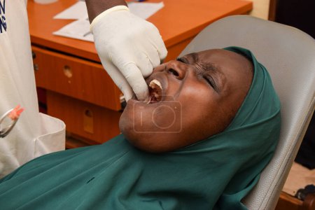 Foto de Opialu, Estado de Benue - 6 de octubre de 2021: Dentista africano brinda ayuda humanitaria a un local en una clínica rural. Africana chica quita su diente - Imagen libre de derechos