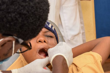 Foto de Lagos, Nigeria - 6 de octubre de 2021: Dentista africano brinda ayuda humanitaria a un local en una clínica rural. Africana chica quita su diente - Imagen libre de derechos