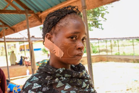 Téléchargez les photos : Karara, État de Nasarawa - 5 mai 2021 : Portrait d'un enfant africain avec patch sur poussin - en image libre de droit