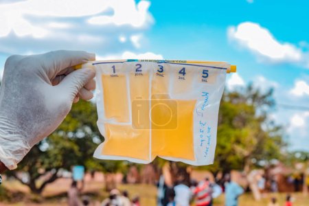 Foto de Yola, Adamawa State - 6 de marzo de 2021: Kit de pruebas de agua in situ en comunidades rurales. Kit de prueba de agua limpia AquagenX. Control de Calidad del Agua en Comunidad Rural Africana. - Imagen libre de derechos