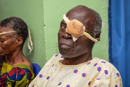 Photo for Abuja, Nigeria - December 25, 2021: Middle-aged African people Diagnosed of Cataract in the eye and Prepared for Surgery - Royalty Free Image