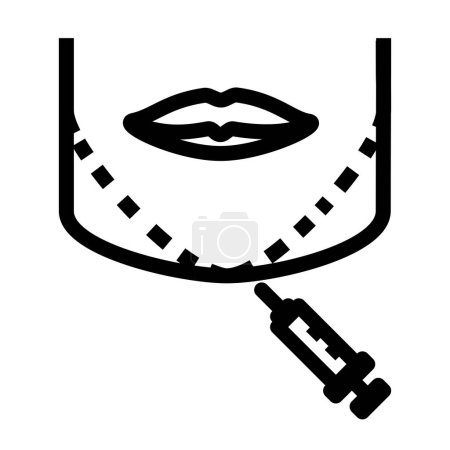 Ilustración de La reducción de la mandíbula por inyección es un procedimiento cosmético no quirúrgico que implica el uso de sustancias inyectables, como Botox o rellenos dérmicos, para remodelar y adelgazar la mandíbula.. - Imagen libre de derechos
