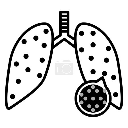 La pollution par les particules provoque des maladies respiratoires comme l'asthme, la BPCO et le cancer du poumon en raison de l'inhalation de particules fines et de gaz toxiques, ce qui entraîne une toux, une respiration sifflante et des difficultés respiratoires..