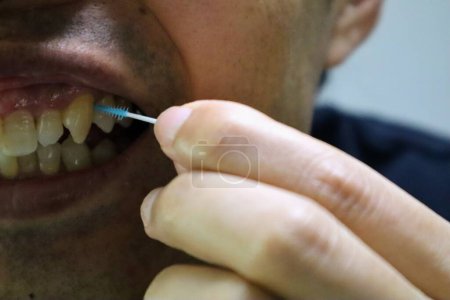 Téléchargez les photos : Une personne nettoie les espaces entre les dents avec une brosse interdentaire - en image libre de droit