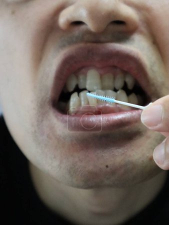 Téléchargez les photos : Une personne nettoie les espaces entre les dents avec une brosse interdentaire - en image libre de droit