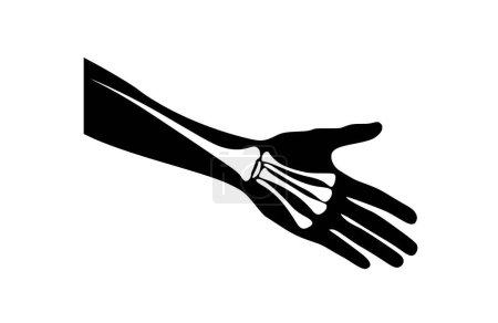 Arm pain black icon, isolated on white background. Vector illustration.