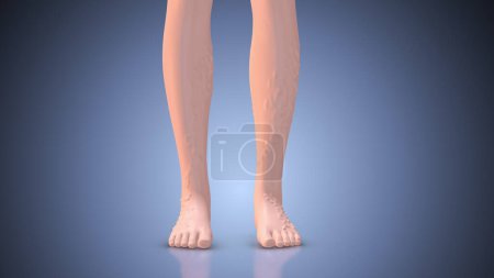 Varicose veins and leg diseases.