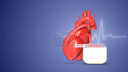 Photo for Cardiac pacemaker heartbeat wave linesrt - Royalty Free Image