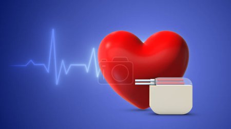 Photo for Heartbeat wave lines with a cardiac pacemaker - Royalty Free Image