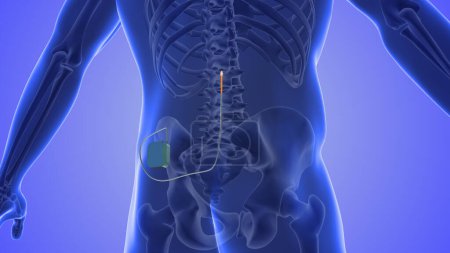 Concepto médico de estimulación de la médula espinal