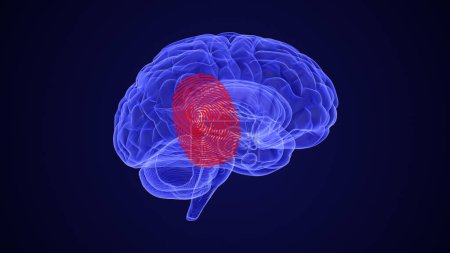 Cartographie de la douleur chronique dans le cerveau