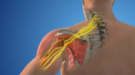 Le réseau des nerfs du plexus brachial dans la structure de l'épaule