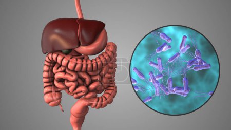 Téléchargez les photos : Infection de l'estomac par Helicobacter pylori - en image libre de droit