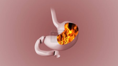 Photo for Burning sensation and stomach discomfort - Royalty Free Image
