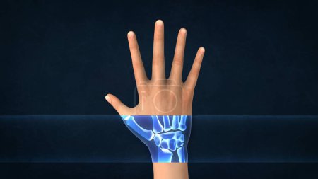 Una radiografía de una mano humana
