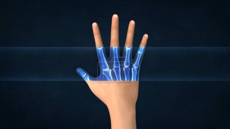 An X-ray of a human hand