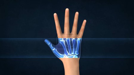 Una radiografía de una mano humana
