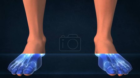 An X-ray of a human feet