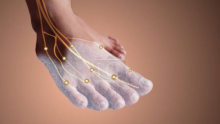 Photo for Tingling nerve injury in foot - Royalty Free Image