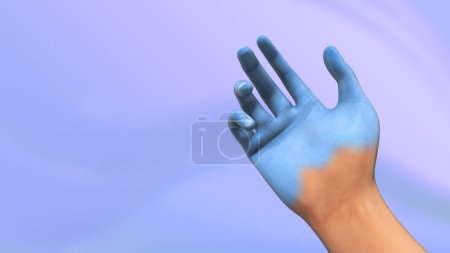 Photo for Symptoms of human hand nerves - Royalty Free Image