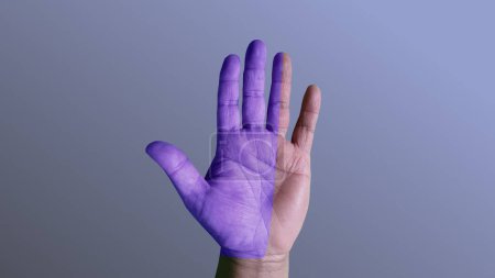 Photo for Medical background of the hand numbness - Royalty Free Image