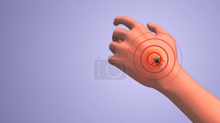 Lyme hand red cells animation