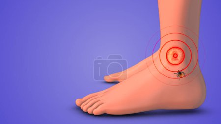 Lyme feet red cells animation