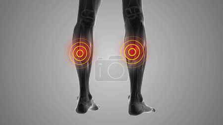 Photo for Leg calf discomfort that trigger pain - Royalty Free Image