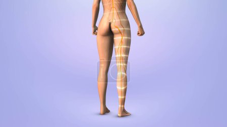 Trigger point for sciatica in human body leg