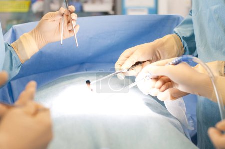Téléchargez les photos : Gros plan sur l'équipe de chirurgiens travaillant en salle d'opération chirurgicale - en image libre de droit