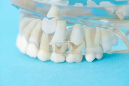 Foto de Modelo dental, modelo de dientes, concepto de odontología - Imagen libre de derechos