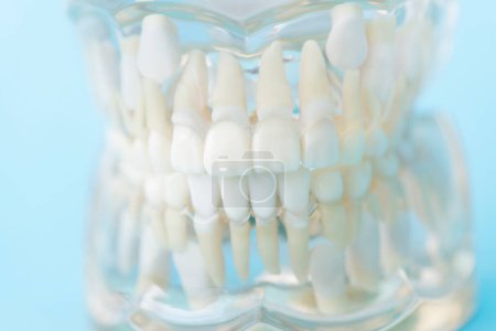 Téléchargez les photos : Modèle dentaire, modèle dentaire, concept de dentisterie - en image libre de droit