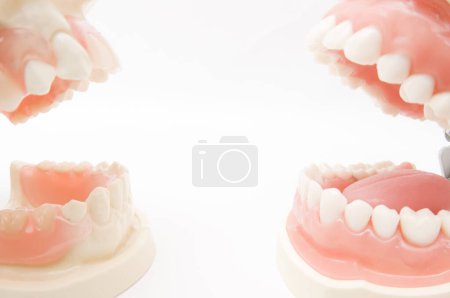 Photo for Implant and orthodontic model for student to learning teaching model showing teeth - Royalty Free Image