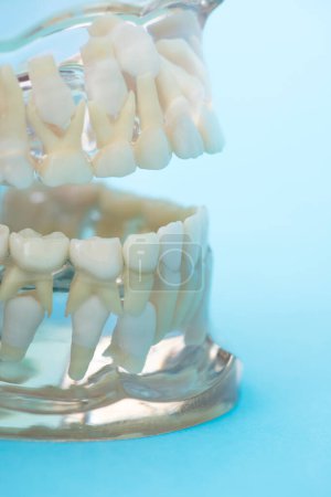 Photo for Dental model, teeth model, concept of dentistry - Royalty Free Image