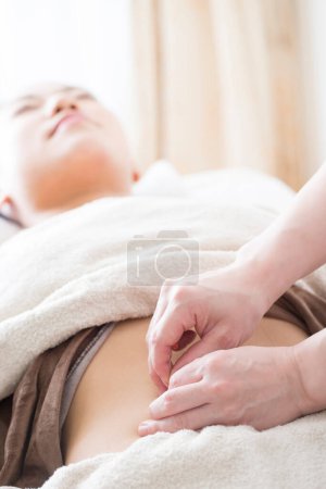 Photo for Asian woman on acupuncture session - Royalty Free Image