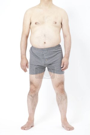 Photo for Fat man in underwear shows fat deposits in abdomen. Concept of not proper nutrition, sedentary lifestyle - Royalty Free Image